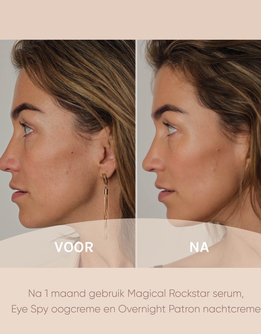 Resultaten muze skincare