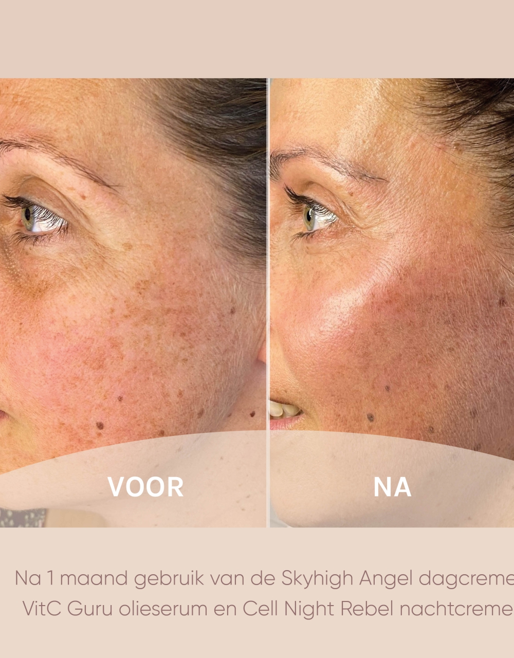 Resultaten muze skincare