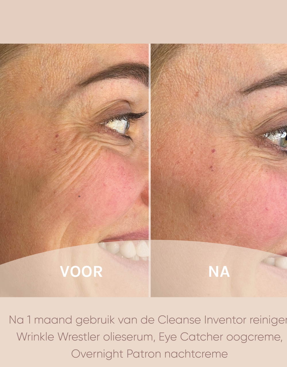 voor en na foto's muze skincare