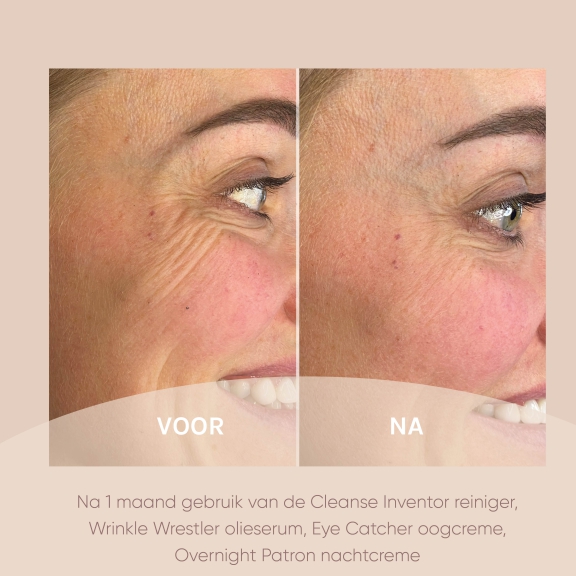 voor en na foto's muze skincare