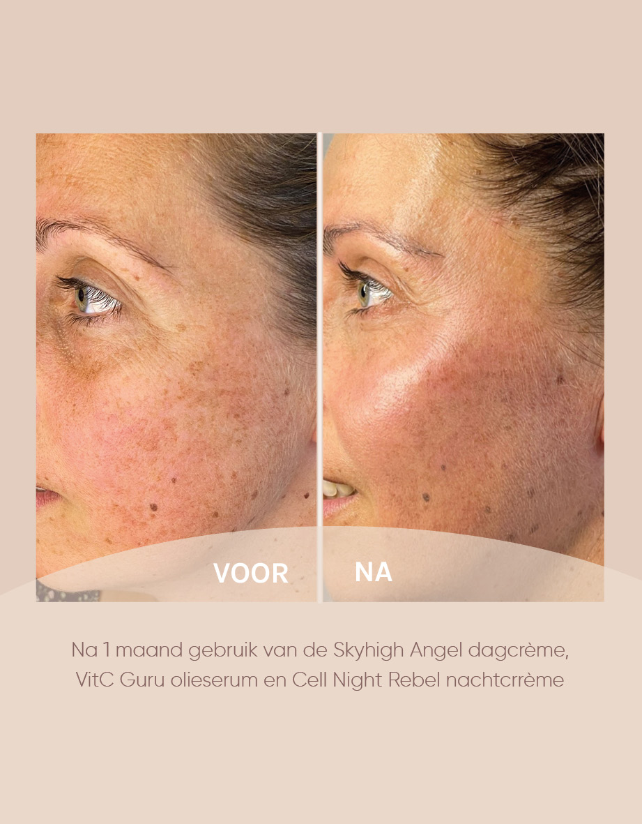 Resultaten Muze Skincare, Voor en na foto's bij gebruik van Skyhigh Angel dagcreme, VitC Guru serum en Cell Night Rebel nachtcreme