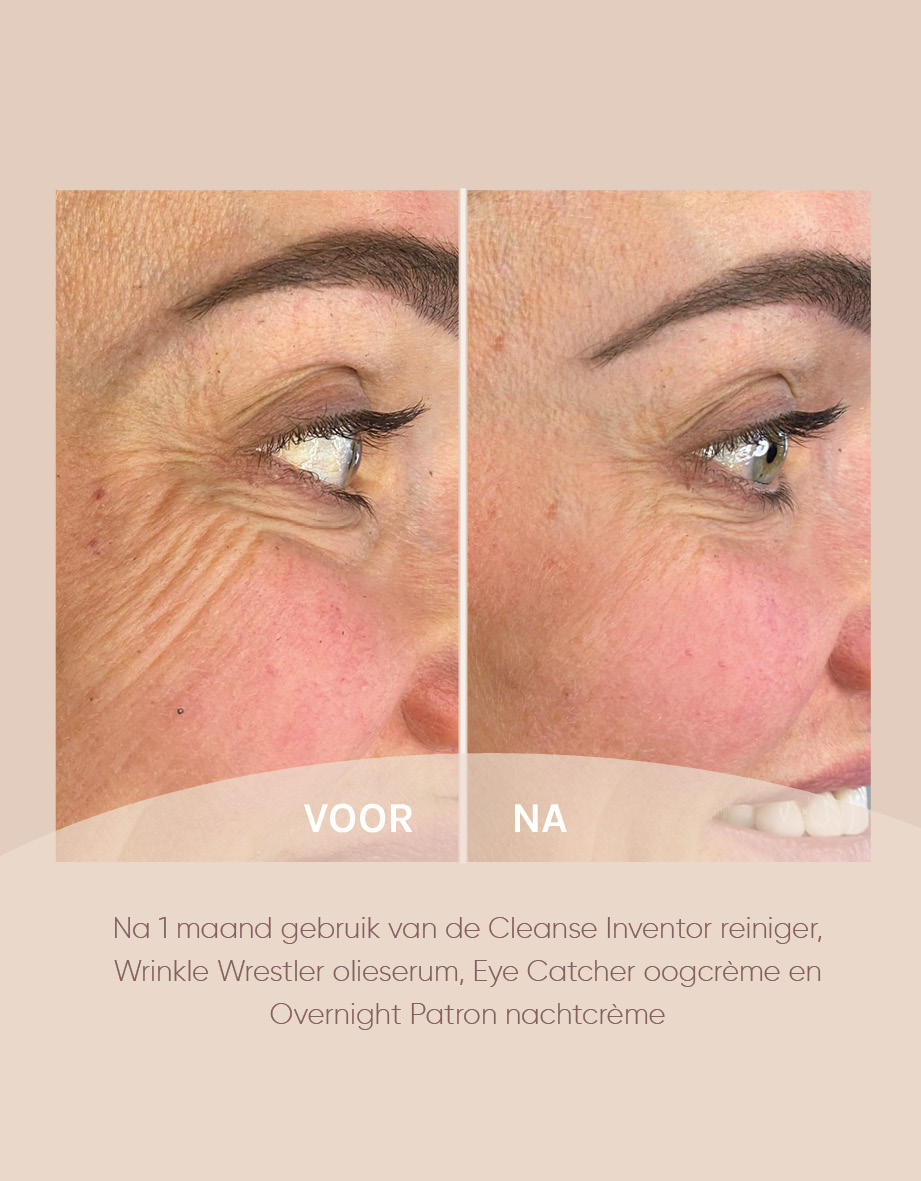 Resultaten muze skincare na 1 maand gebruik van de Cleanse Inventor reiniger, Wrinkle Wrestler olieserum, Eye Catcher oogcrème en Overnight Patron nachtcrème