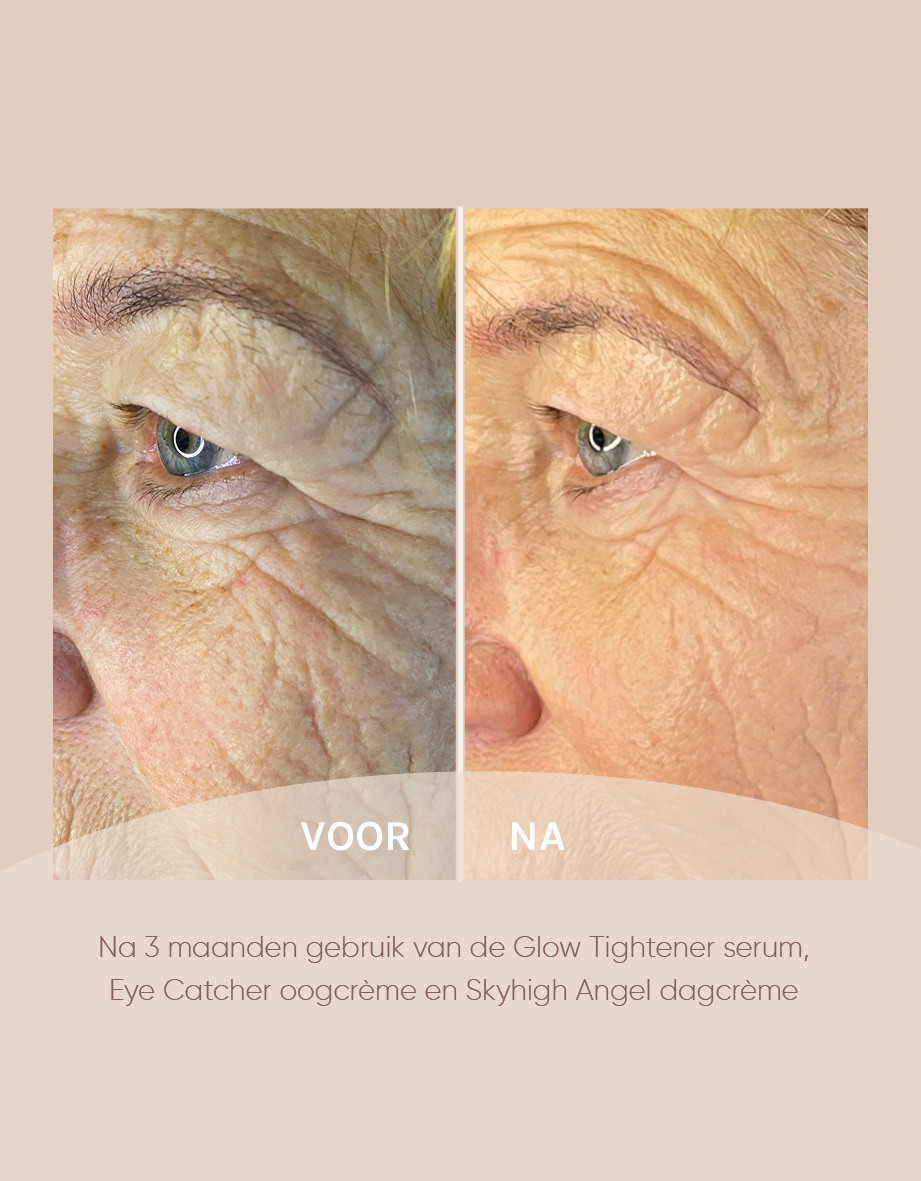 Resultaten na 3 maanden gebruik van de Glow Tightener serum, Eye Catcher oogcrème en Skyhigh Angel dagcrème