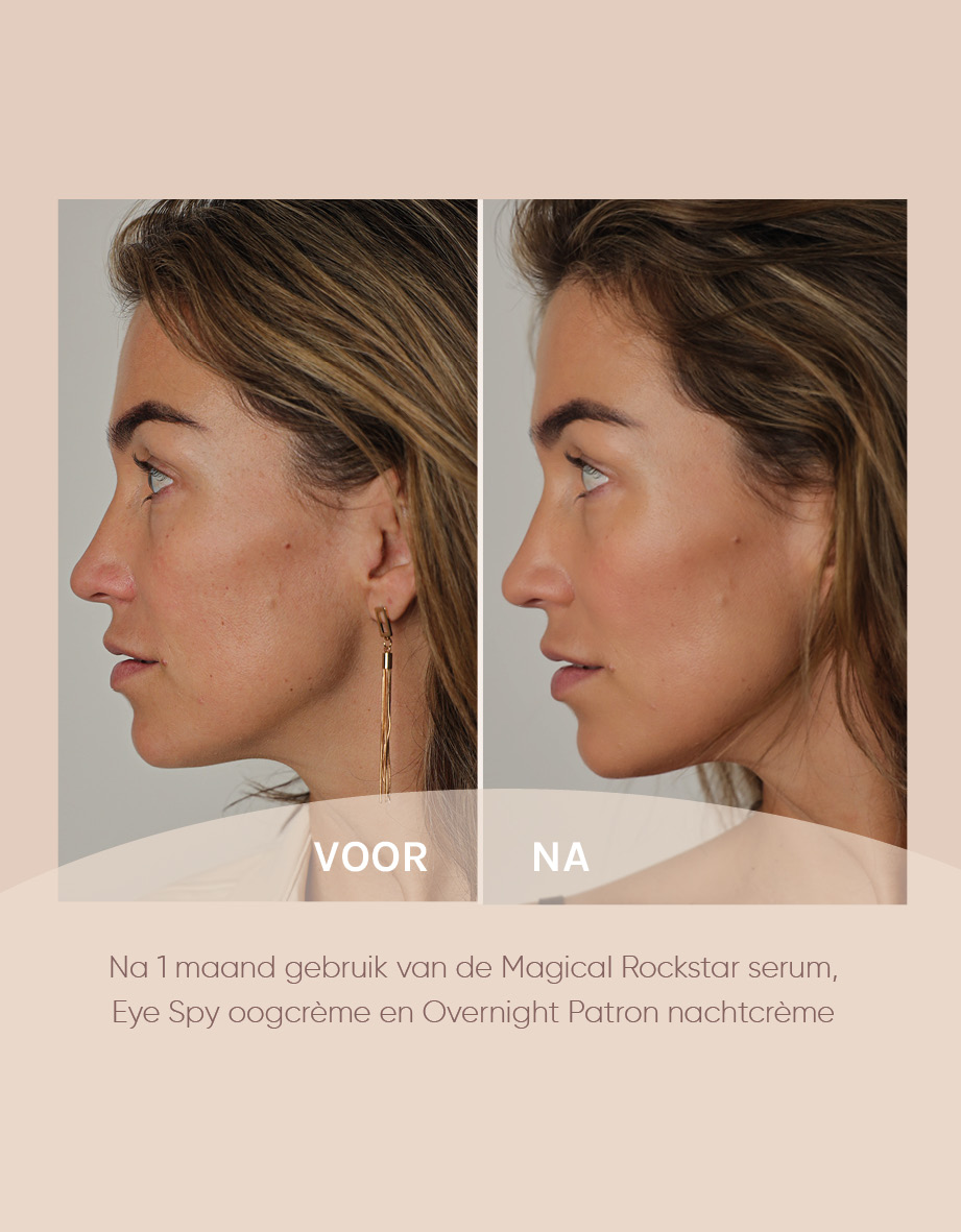 Resultaten na 1 maand gebruik van de Magical Rockstar serum, Eye Spy oogcrème en Overnight Patron nachtcrème